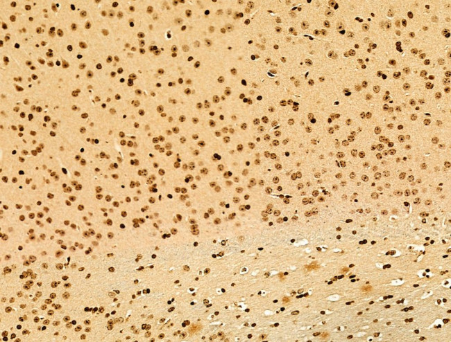 Phospho-SREBP1 (Ser439) Antibody in Immunohistochemistry (Paraffin) (IHC (P))