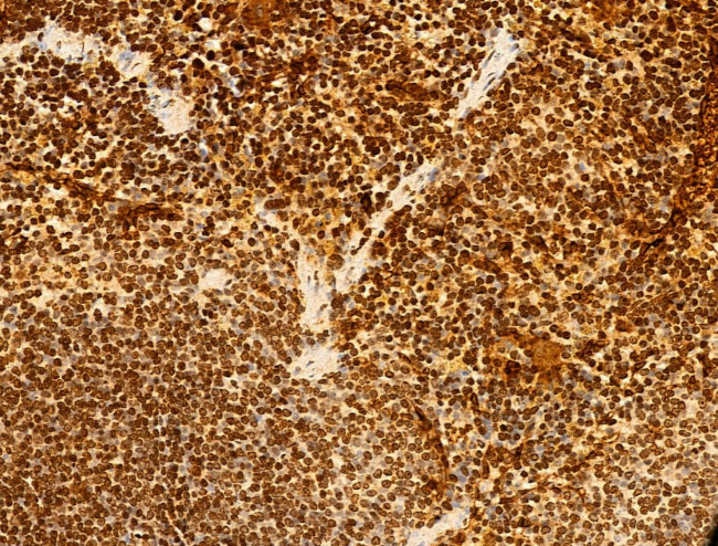 Phospho-SREBP1 (Ser439) Antibody in Immunohistochemistry (Paraffin) (IHC (P))