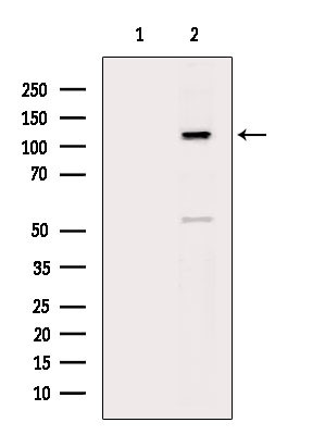 Phospho-SREBP1 (Ser439) Antibody in Western Blot (WB)