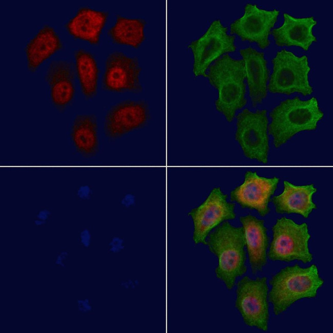 Phospho-p21 (Thr145) Antibody in Immunocytochemistry (ICC/IF)