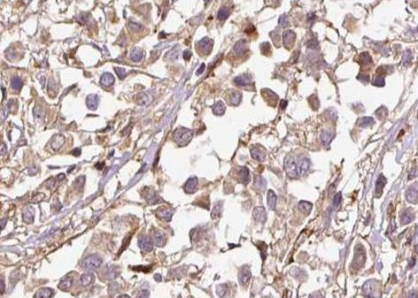 Phospho-p21 (Thr145) Antibody in Immunohistochemistry (Paraffin) (IHC (P))