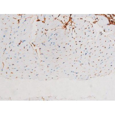 Phospho-JNK1/JNK2/JNK3 (Thr183) Antibody in Immunohistochemistry (Paraffin) (IHC (P))