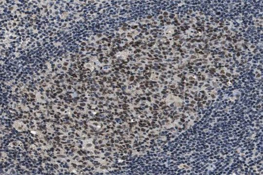 Phospho-GSK3 alpha (Ser21) Antibody in Immunohistochemistry (Paraffin) (IHC (P))