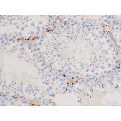 Phospho-SMAD2/SMAD3 (Thr8) Antibody in Immunohistochemistry (Paraffin) (IHC (P))