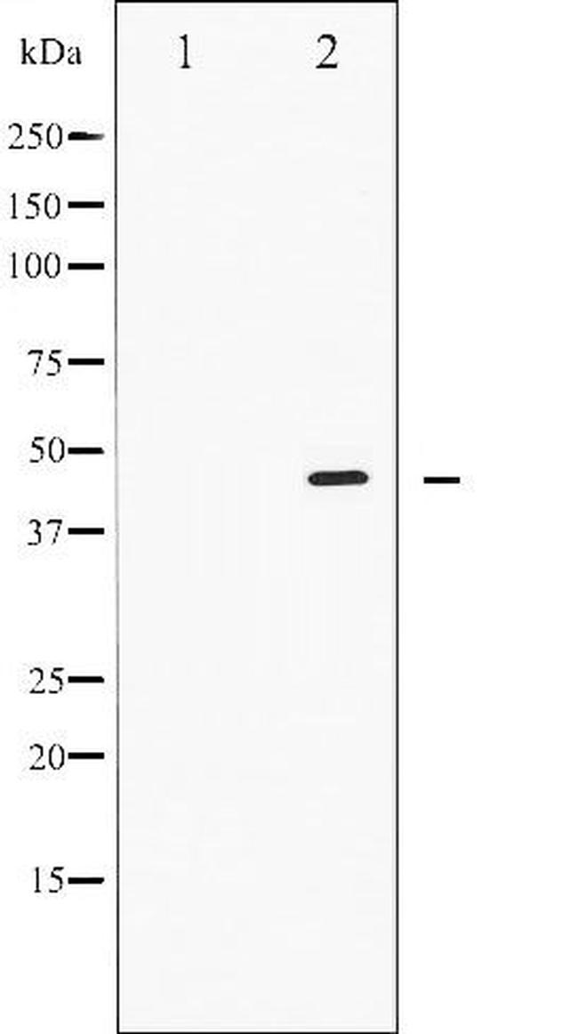 Phospho-SMAD2/SMAD3 (Thr8) Antibody in Western Blot (WB)