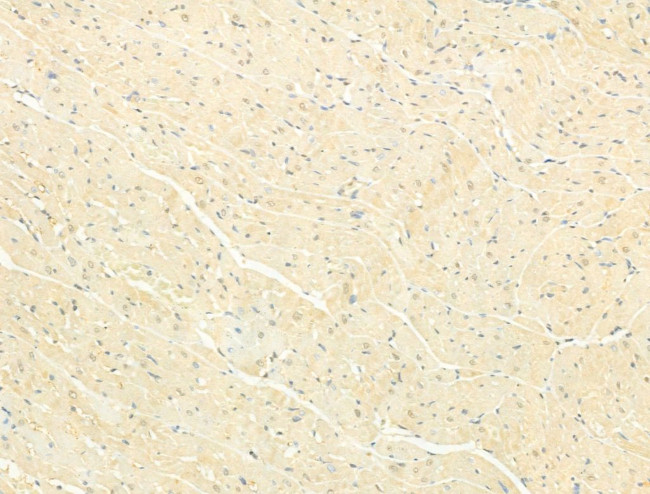 Phospho-SMAD2/SMAD3 (Thr8) Antibody in Immunohistochemistry (Paraffin) (IHC (P))