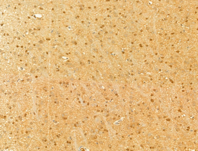 Phospho-SMAD2/SMAD3 (Thr8) Antibody in Immunohistochemistry (Paraffin) (IHC (P))