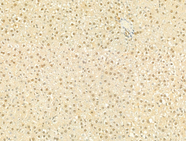 Phospho-SMAD2/SMAD3 (Thr8) Antibody in Immunohistochemistry (Paraffin) (IHC (P))