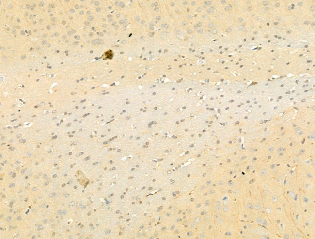 Phospho-SMAD2/SMAD3 (Thr8) Antibody in Immunohistochemistry (Paraffin) (IHC (P))