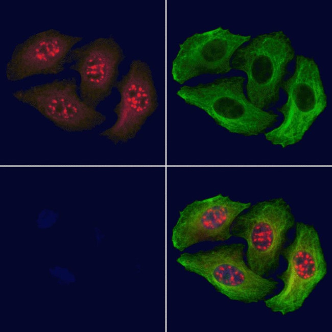 Phospho-MEF2A (Thr319) Antibody in Immunocytochemistry (ICC/IF)