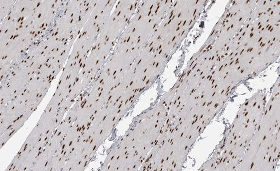 Phospho-MEF2A (Thr319) Antibody in Immunohistochemistry (Paraffin) (IHC (P))