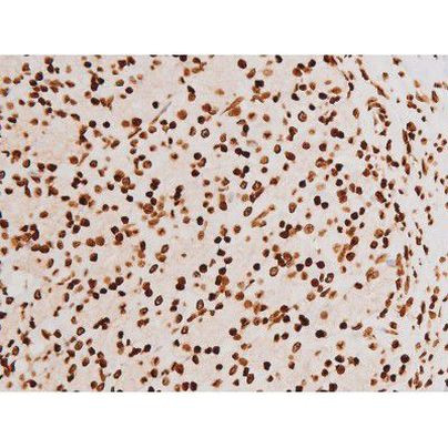 Phospho-C-rel (Ser503) Antibody in Immunohistochemistry (Paraffin) (IHC (P))