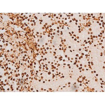 Phospho-C-rel (Ser503) Antibody in Immunohistochemistry (Paraffin) (IHC (P))