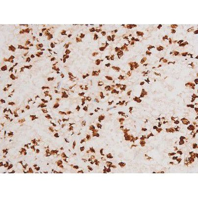 Phospho-C-rel (Ser503) Antibody in Immunohistochemistry (Paraffin) (IHC (P))