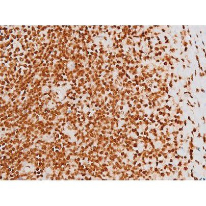 Phospho-C-rel (Ser503) Antibody in Immunohistochemistry (Paraffin) (IHC (P))