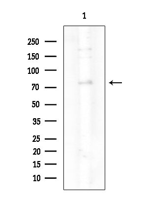 Phospho-PKC delta (Ser645) Antibody in Western Blot (WB)