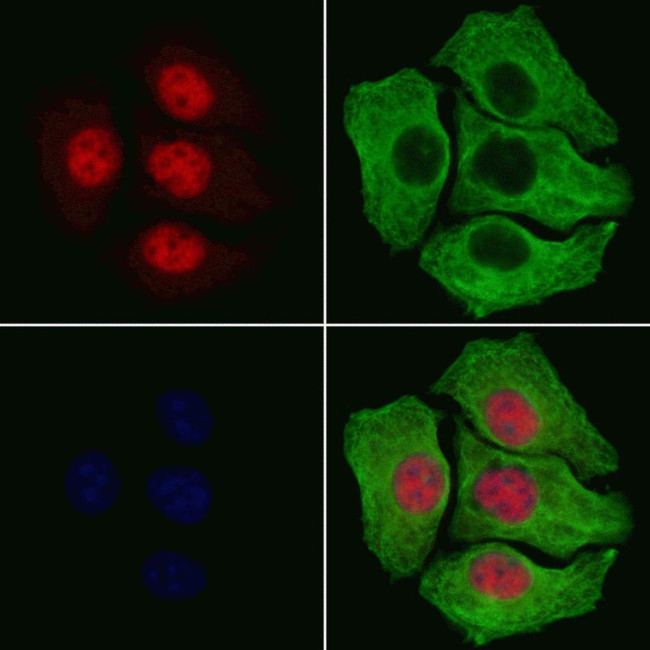 Phospho-IkappaB beta (Ser19) Antibody in Immunocytochemistry (ICC/IF)