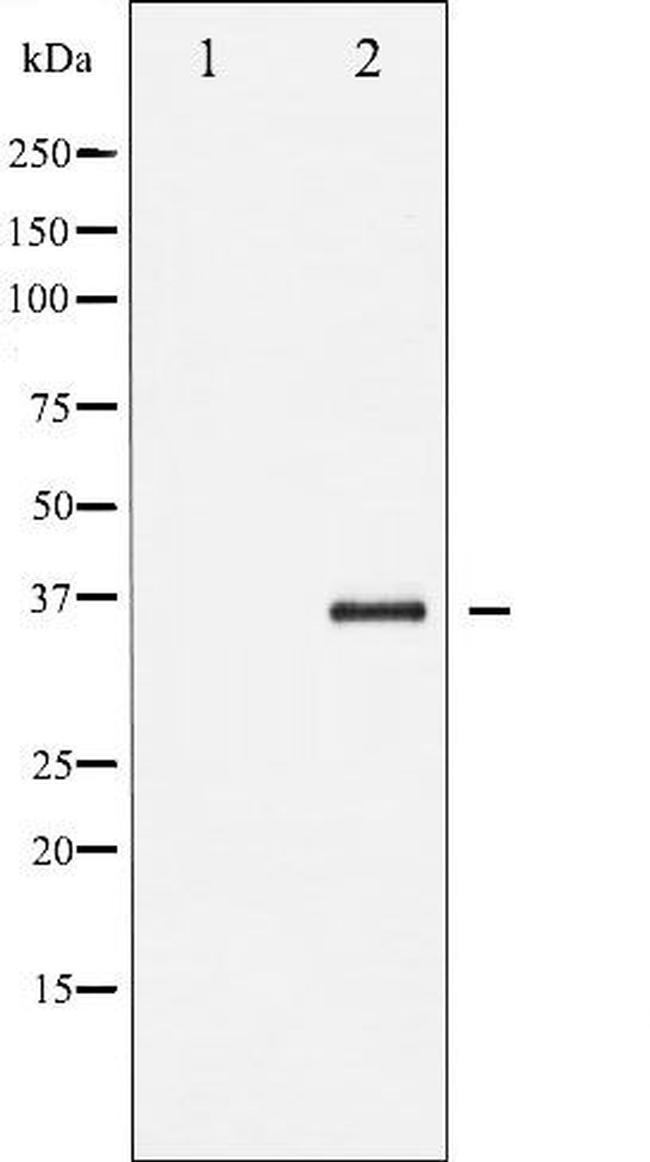 Phospho-IkappaB beta (Ser19) Antibody in Western Blot (WB)