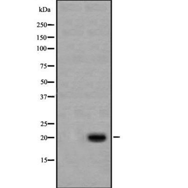Caspase 1 p20 (Cleaved Asp296) Antibody in Western Blot (WB)