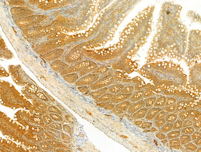 PIK3CA Antibody in Immunohistochemistry (Paraffin) (IHC (P))