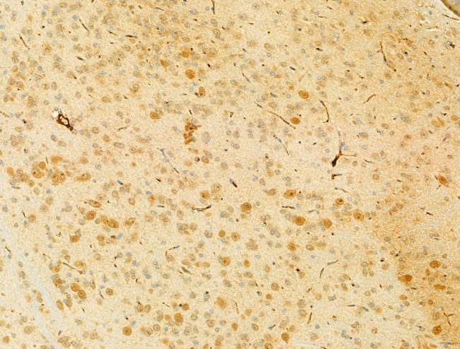 PIK3CA Antibody in Immunohistochemistry (Paraffin) (IHC (P))