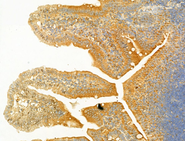 PIK3CA Antibody in Immunohistochemistry (Paraffin) (IHC (P))