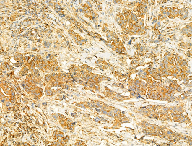 PIK3CA Antibody in Immunohistochemistry (Paraffin) (IHC (P))