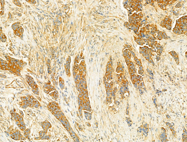 PIK3CA Antibody in Immunohistochemistry (Paraffin) (IHC (P))