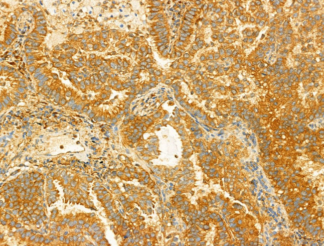 PIK3CA Antibody in Immunohistochemistry (Paraffin) (IHC (P))