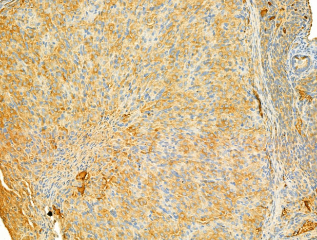 PIK3CA Antibody in Immunohistochemistry (Paraffin) (IHC (P))