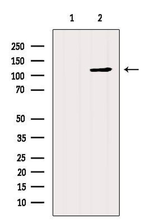 PIK3CA Antibody in Western Blot (WB)