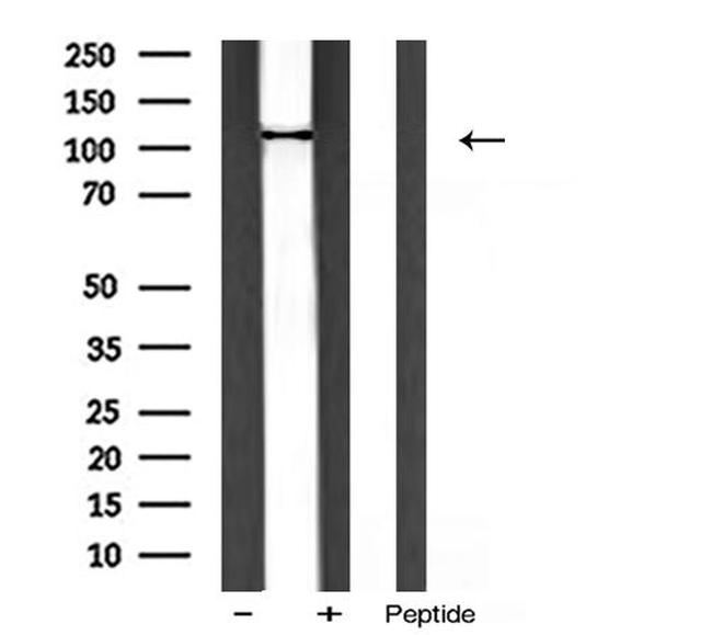 PIK3CA Antibody in Western Blot (WB)