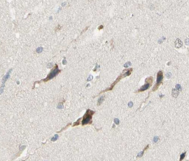 IL-5 Antibody in Immunohistochemistry (Paraffin) (IHC (P))