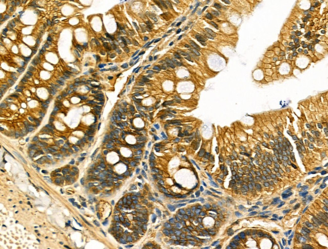 IL-5 Antibody in Immunohistochemistry (Paraffin) (IHC (P))