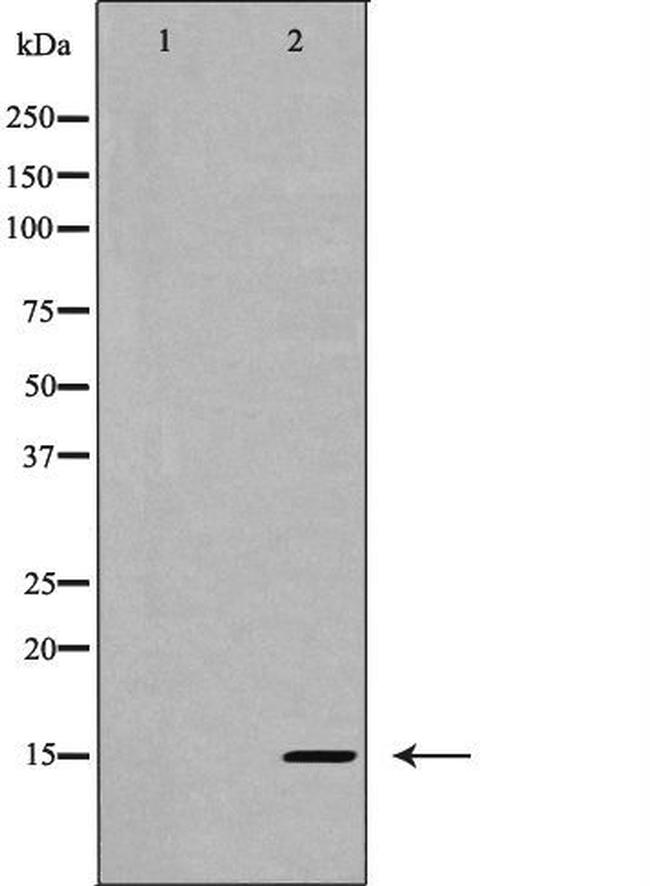 IL-5 Antibody in Western Blot (WB)