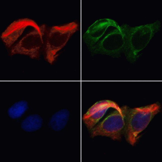 CD122 Antibody in Immunocytochemistry (ICC/IF)