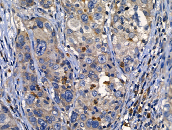 CD122 Antibody in Immunohistochemistry (Paraffin) (IHC (P))