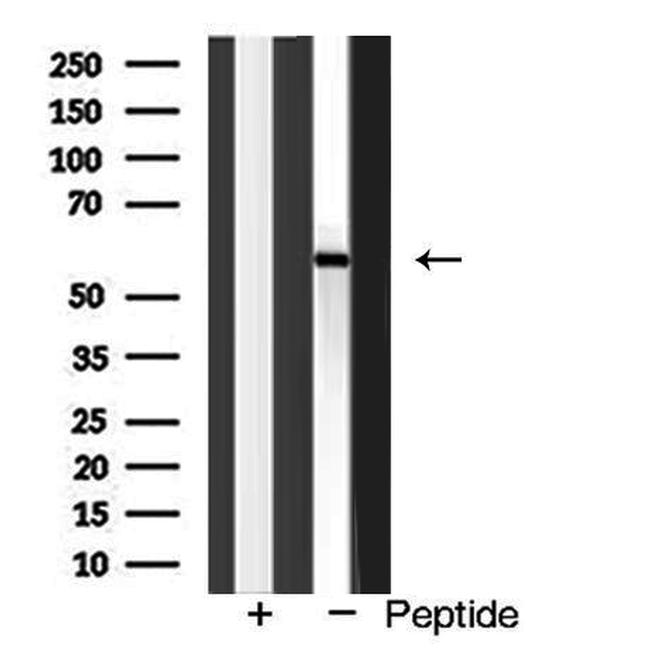 CD122 Antibody in Western Blot (WB)