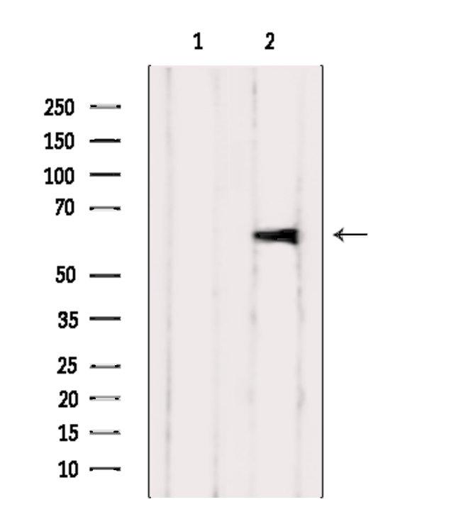 CD122 Antibody in Western Blot (WB)