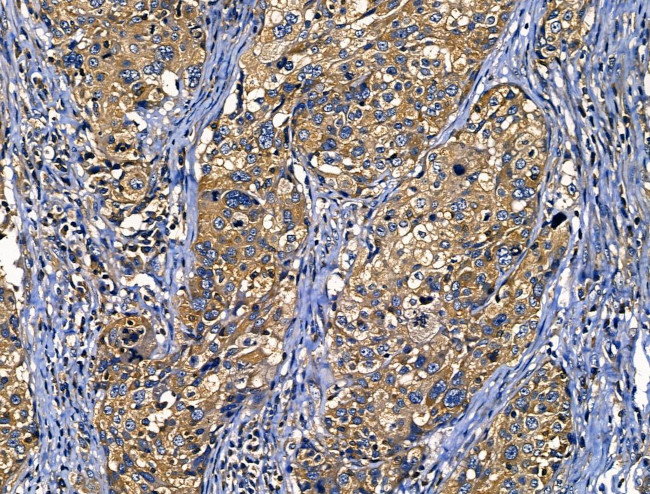 CD103 Antibody in Immunohistochemistry (Paraffin) (IHC (P))