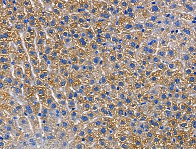 CD103 Antibody in Immunohistochemistry (Paraffin) (IHC (P))