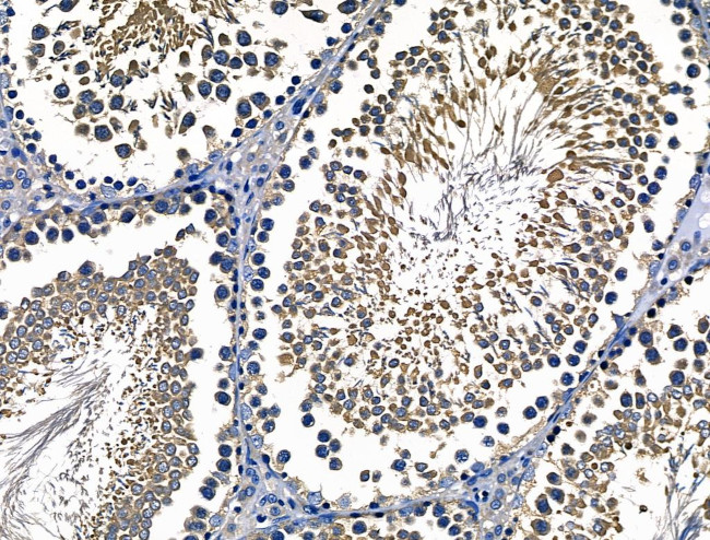 CD103 Antibody in Immunohistochemistry (Paraffin) (IHC (P))