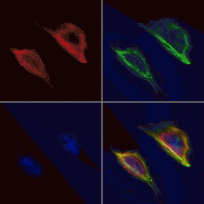 Aquaporin 5 Antibody in Immunocytochemistry (ICC/IF)