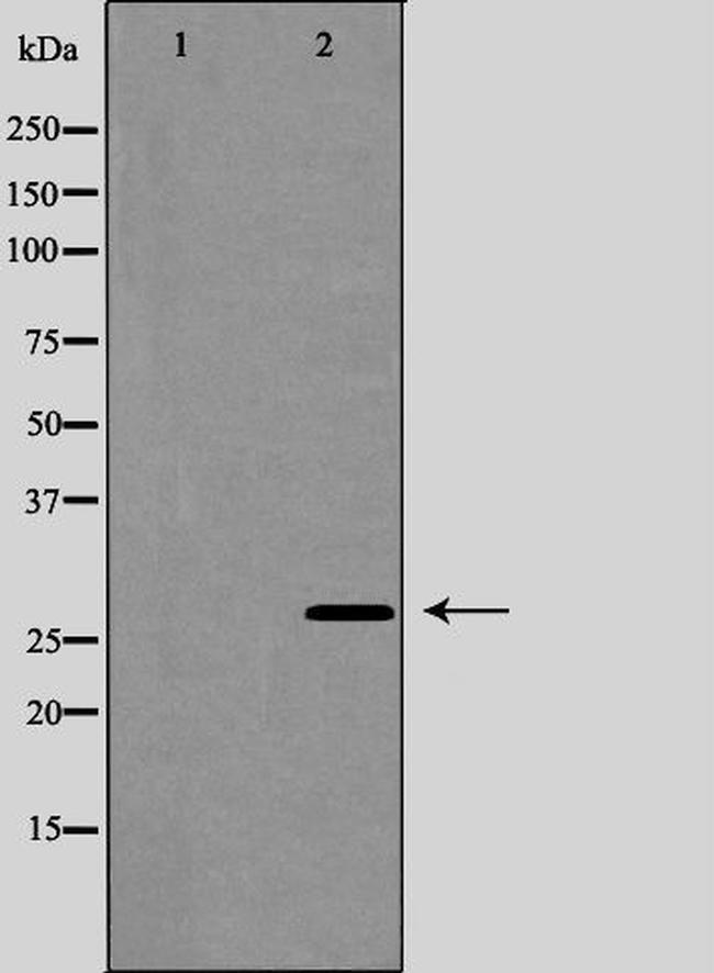 Aquaporin 5 Antibody in Western Blot (WB)