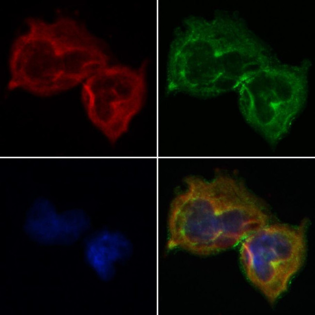 SERPINB2 Antibody in Immunocytochemistry (ICC/IF)