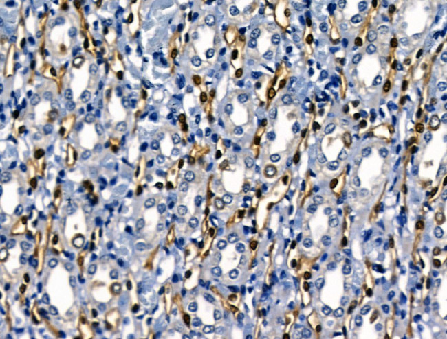 SERPINB2 Antibody in Immunohistochemistry (Paraffin) (IHC (P))