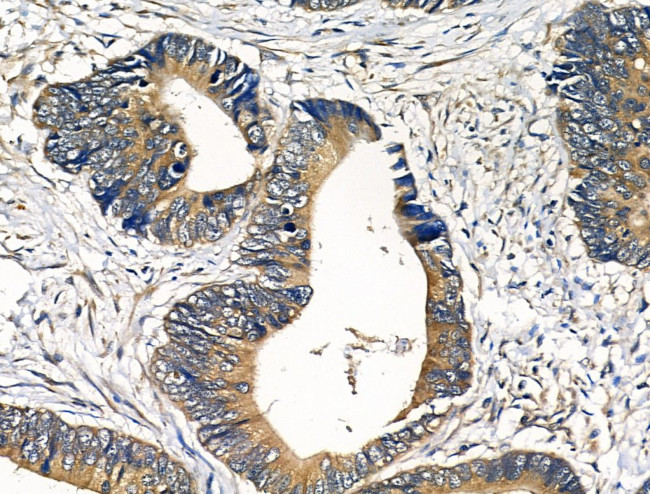 PDGF-A Antibody in Immunohistochemistry (Paraffin) (IHC (P))