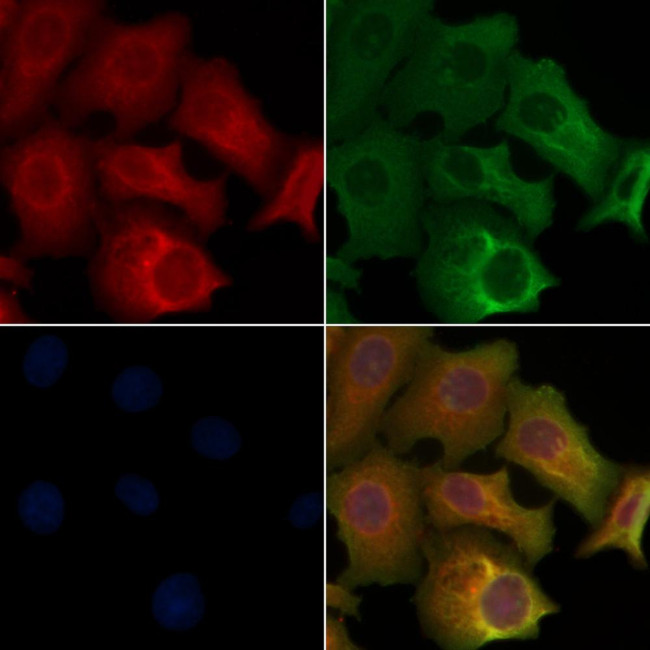 Cathepsin E Antibody in Immunocytochemistry (ICC/IF)