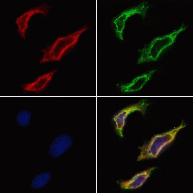 Cathepsin E Antibody in Immunocytochemistry (ICC/IF)