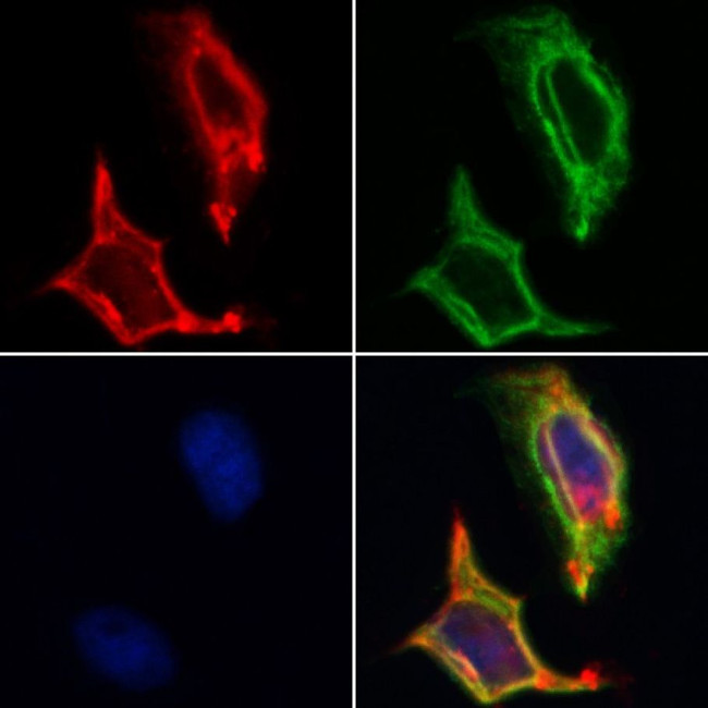 ITGA3 Antibody in Immunocytochemistry (ICC/IF)